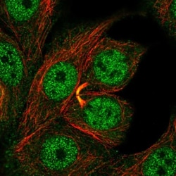 GDPD3 Antibody, Novus Biologicals 25 &mu;L; Unlabeled:Antibodies, Polyclonal